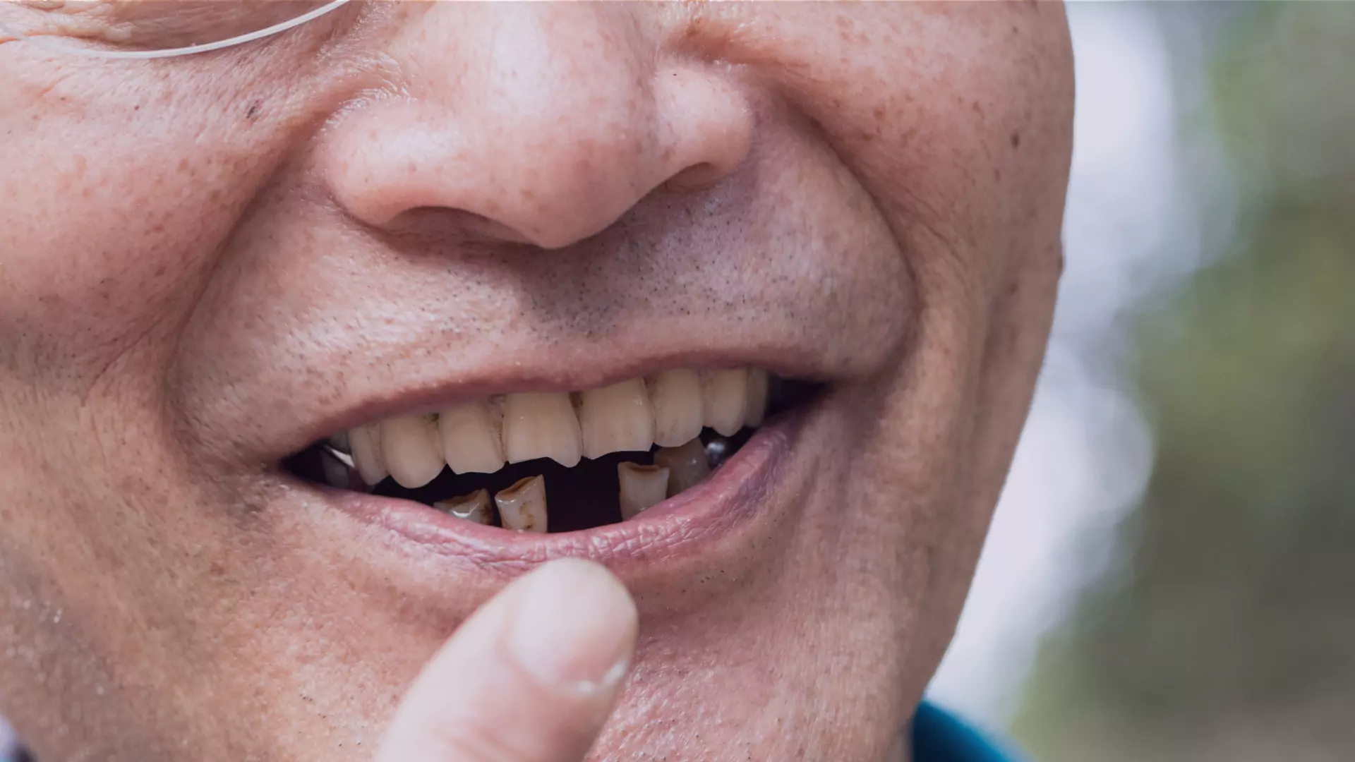 Crean medicamento que podría regenerar los dientes perdidos
