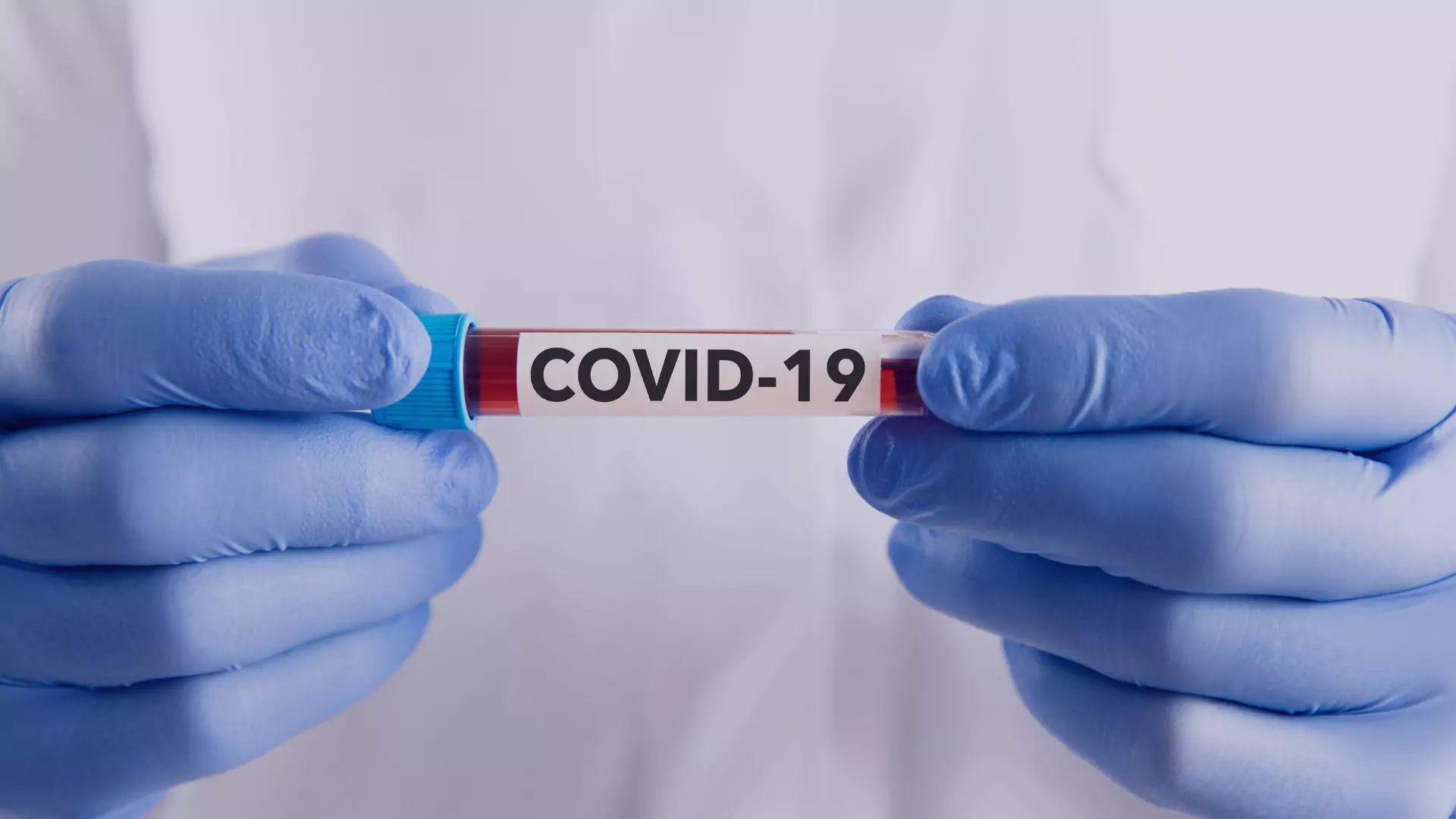 Impacto de la Pandemia por COVID-19 (SARS-CoV 2) en la Educación Odontológica: Scoping Review