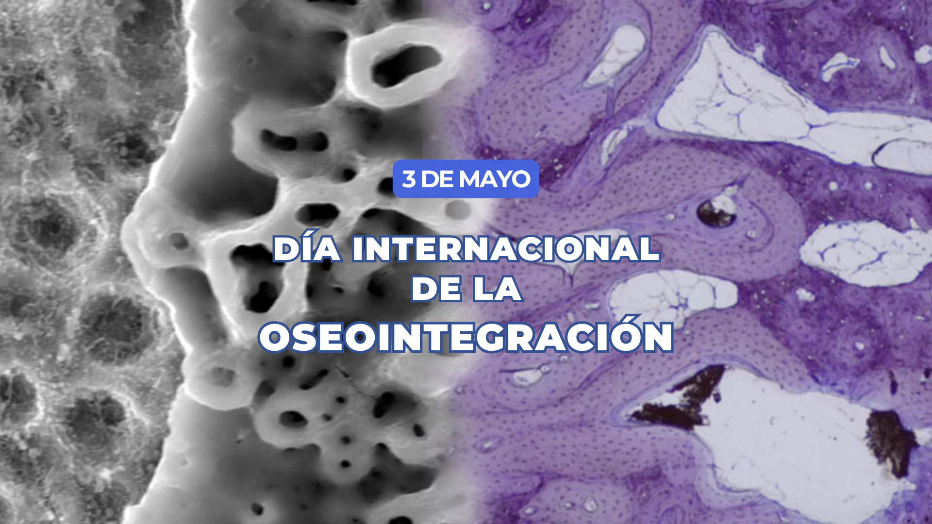Día Internacional de la Oseointegración – Celebrando el legado de Per-Ingvar Brånemark