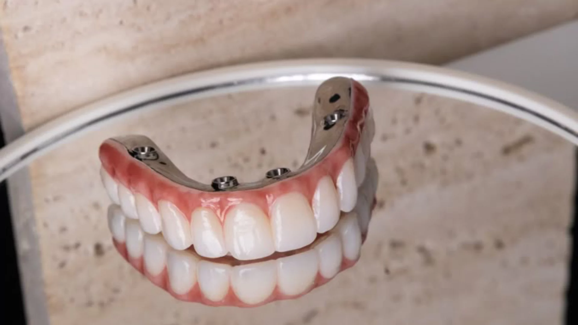 La pérdida de dientes sí afecta tu calidad de vida: estudio en población chilena revela importantes asociaciones