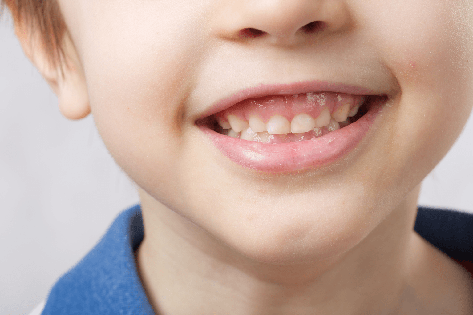 Niño sonriendo con dientes sanos, imagen representativa del XIV Congreso Internacional de Odontopediatría 2026.